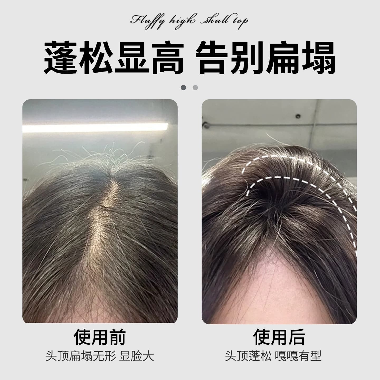 High skull artifact hair root fixing clip hair fluffy clip positioning clip female styling bangs duckbill clip hairpin hair clip 4