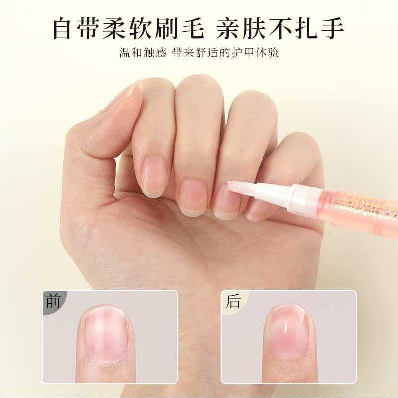 (Wholesale), finger oil for manicure, protective medical fingers protection for nails, nutritious recoverer 2