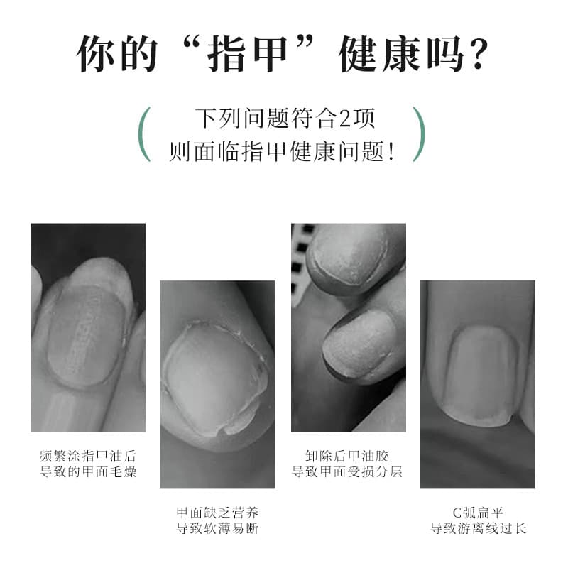 (Wholesale), finger oil for manicure, protective medical fingers protection for nails, nutritious recoverer 4
