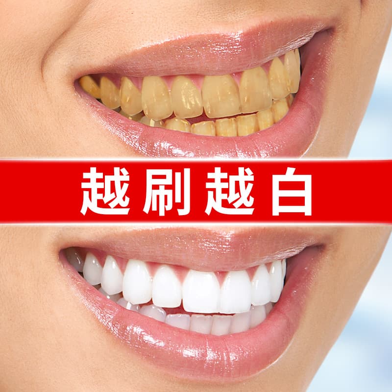Teeth Whitening Pen - Fast Stain & Yellow Teeth Removal 2
