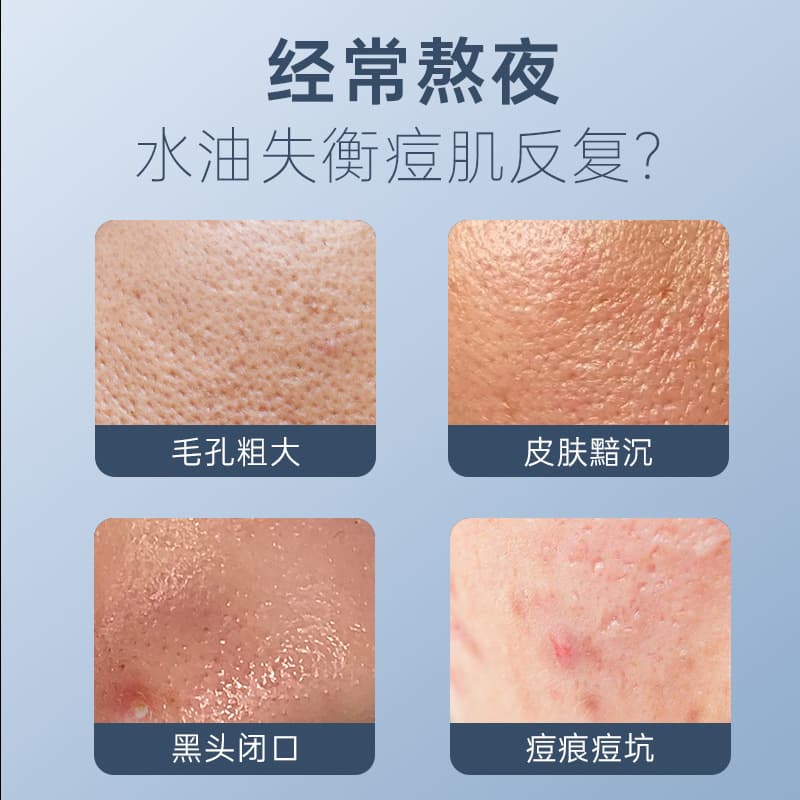Serum with salicylic acid, moisturizing essence for face, shrinks pores, pore cleansing 3