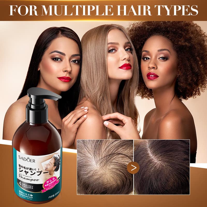 (Cross-border trading), (Wholesale), shampoo, English, dandruff removal 2