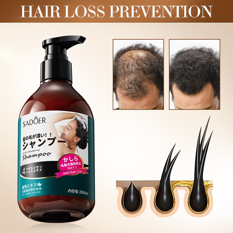 (Cross-border trading), (Wholesale), shampoo, English, dandruff removal 5