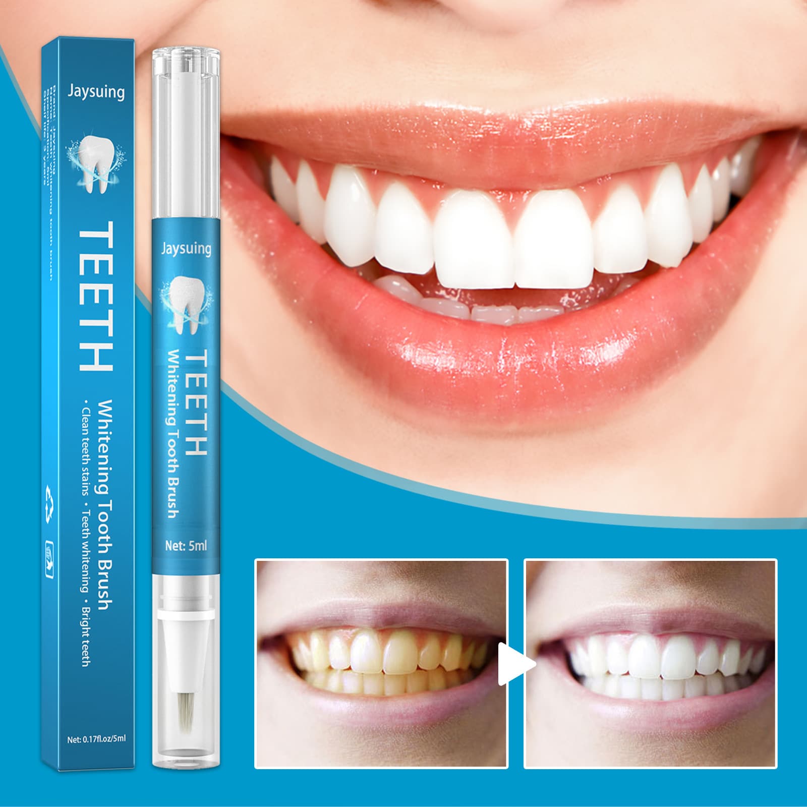 Jaysuing tooth clean white pen Clean the teeth brighter gel mouth cleaning yellow teeth tea staining tooth tooth spots 2