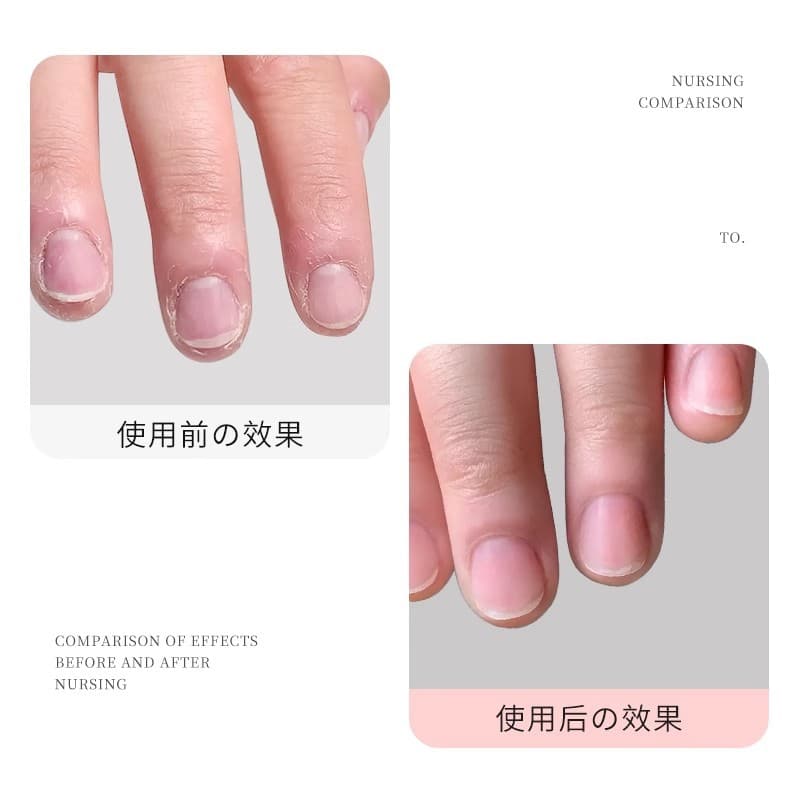 Nutritious exfoliating finger oil for manicure for nails, medical revitalizing gel polish, serum 2