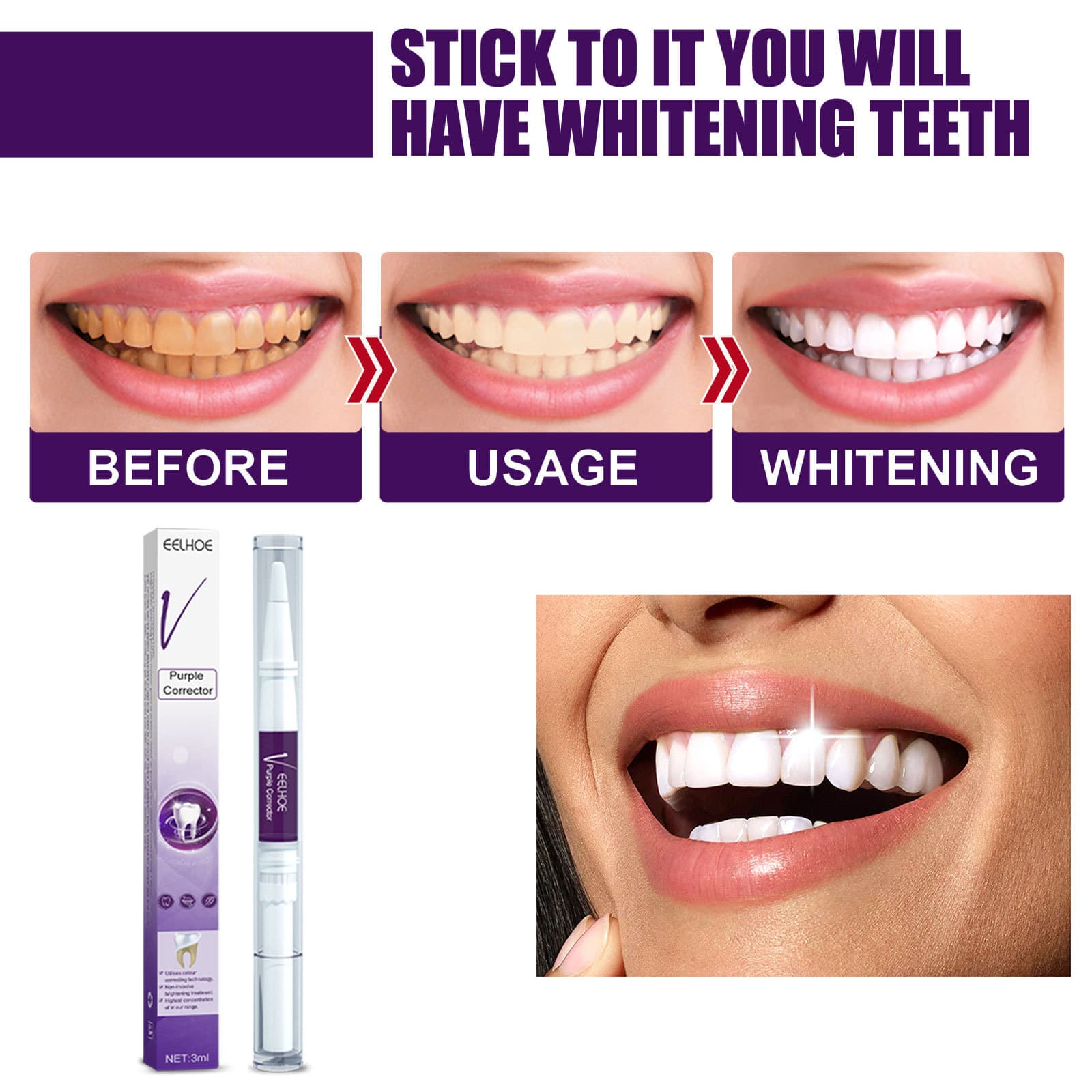 EELHOE V34 Purple Teeth Whitening Pen - Stain & Gloss Care 2