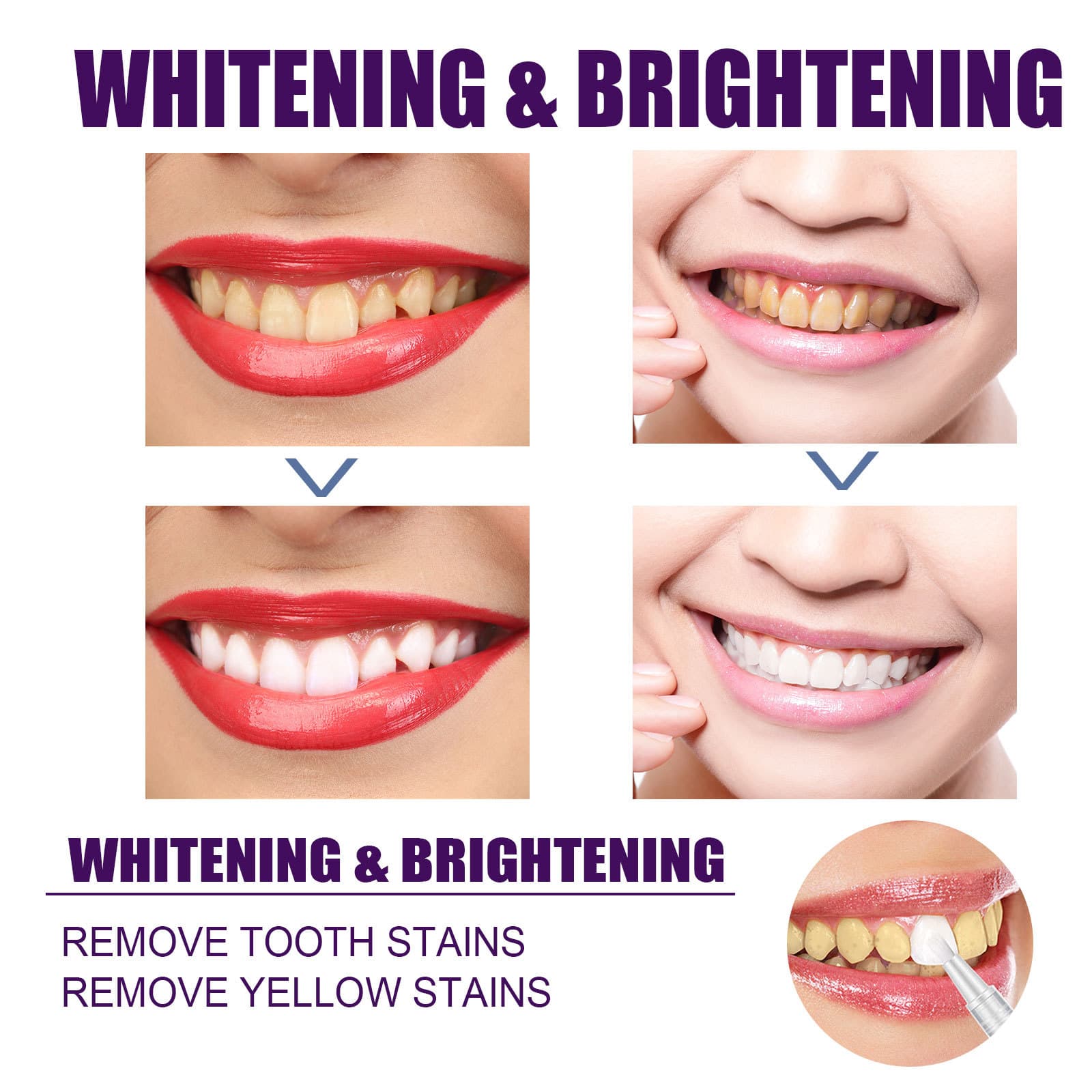EELHOE V34 Purple Teeth Whitening Pen - Stain & Gloss Care 5