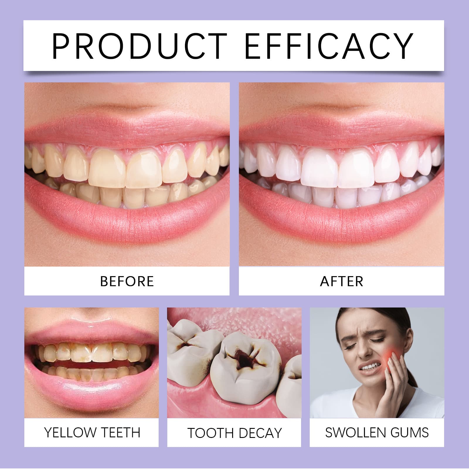 OUHOE Meridity Pen tooth Gentle Cleaning Care to Sickly Denta tooth Stainless tooth Yellow Care for the Teeth Care 2