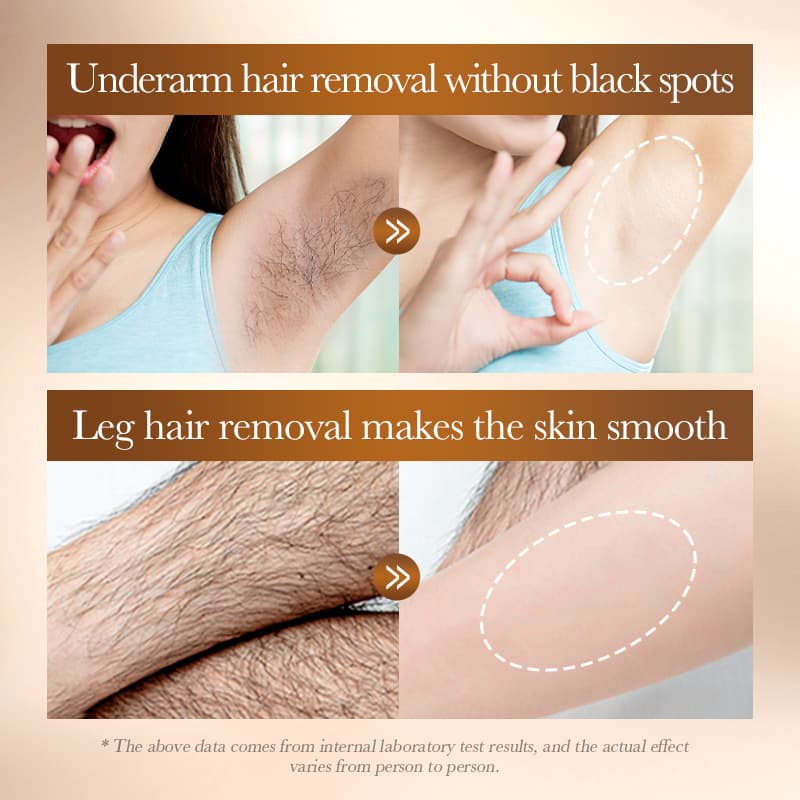 (Cross-border trading), (Wholesale), rice soft milk, medical set, hair removal cream, English, 2 pieces 4